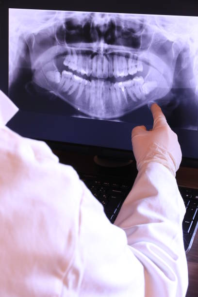 Best Emergency Tooth Extraction in Grant, MI